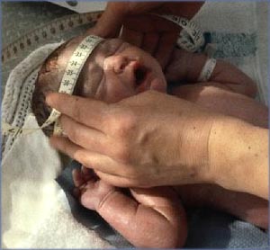 Newborn baby having his head measured right after birth.